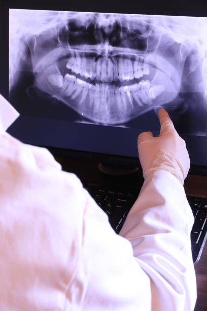 Best Emergency Tooth Extraction  in Tahoma, CA